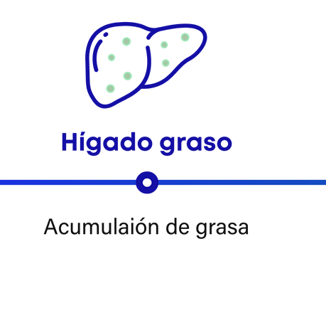 Cómo progresa la MASH: hígado graso tiene acumulación de grasa