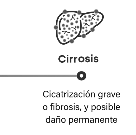Cómo progresa la MASH: la cirrosis es una fibrosis o cicatrización grave que puede provocar un posible daño permanente