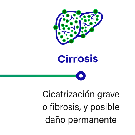 Cómo progresa la MASH: la cirrosis es una fibrosis o cicatrización grave que puede provocar un posible daño permanente