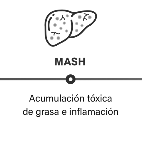Cómo progresa la MASH: la MASH puede causar acumulación tóxica e inflamación